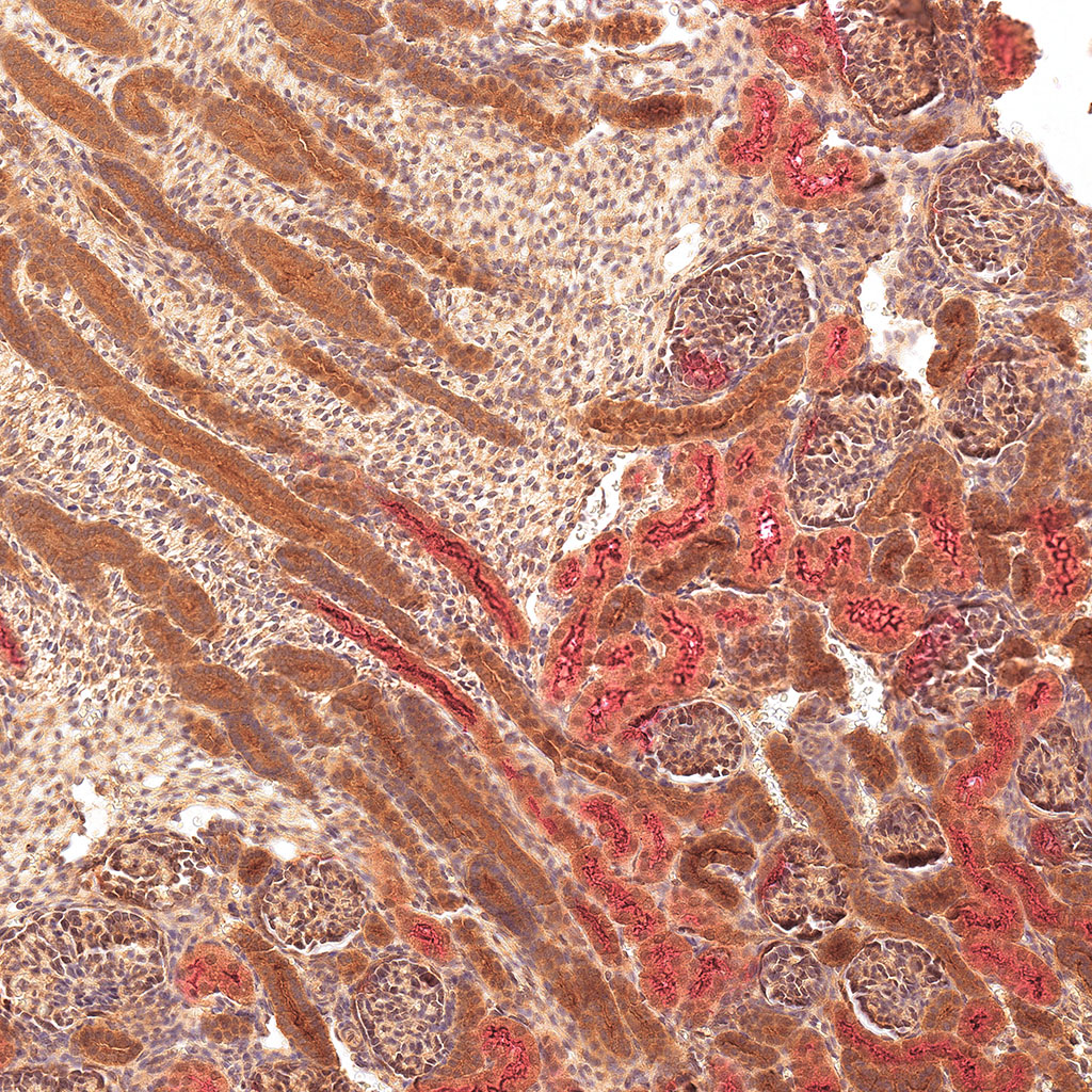 sars-cov-2 gene expression in a human fetus